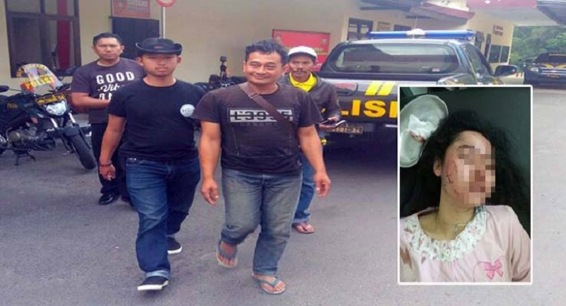 SADIS...Cemburu dan Takut Istri Selingkuh, Gufron Tega Sayat Wajah Cantik Ana Nur Rahmawati dengan Pisau Dapur