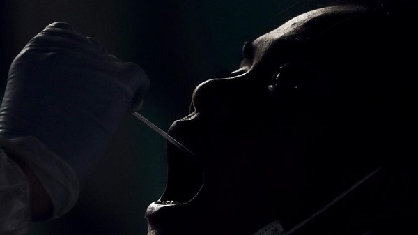 WADUH! Hidung Meler Terus, Ternyata Cairan Otak Bocor Diduga Saat Lakukan Swab Covid-19