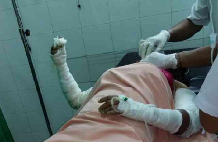 JAHAT...Mantan Suami Cemburu Buta, Yeni Dibakar Hidup-hidup