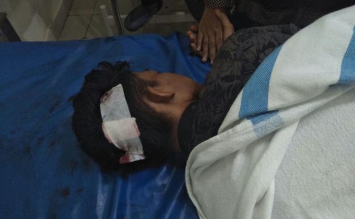 Nonton Orgen Tunggal, Dua Pemuda di Inhil Terkena Sabetan Senjata Tajam, Berdarah-darah