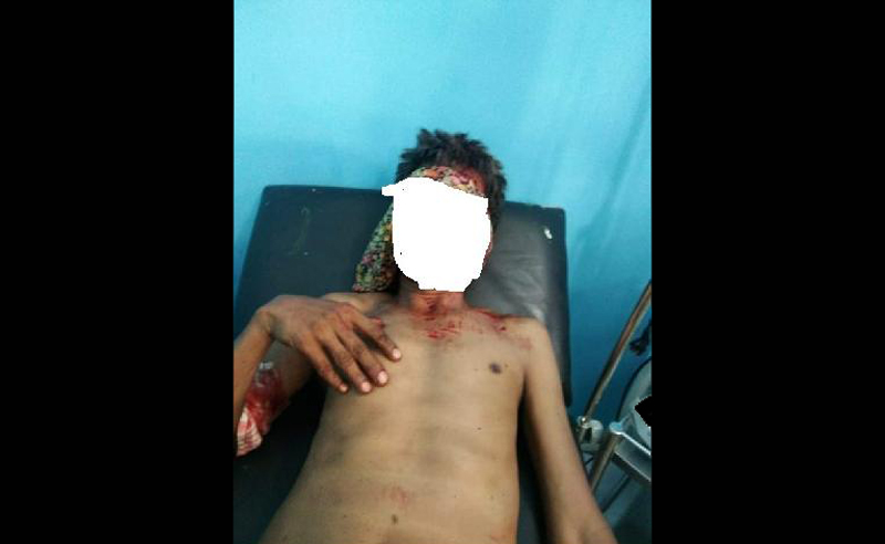 MENGERIKAN...Petani Karet di Kuansing Diserang Beruang, Wajah Luka Parah dan Beradarah-darah