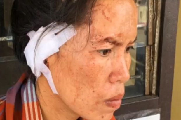 Kejam! Hanya Jarang Disiapin Makanan, Suami Potong Daun Telinga Istrinya Pakai Kulit Bambu