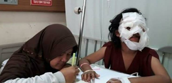 JAHAT... Nenek Tiri Ceburkan Wajah Cucunya ke dalam Wajan Penuh Minyak Panas, Melepuh dan Menghitam 