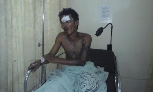Terpegang Kabel Listrik, Pria Bengkalis Ini Terpental, Tubuhnya Hangus Terbakar