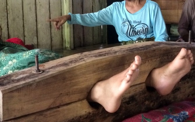 GAWAT...Dianggap Aib Keluarga, Ratusan 'Orang Gila' Dipasung di Riau