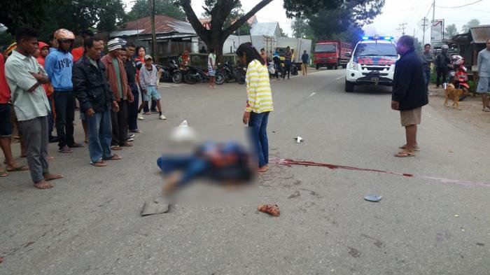 YA TUHAN...Dilindas Pikap, Tengkorak Kepala Pria Ini Pecah, Otak Tercecer