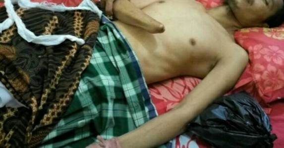 Pakai Pisau Cutter, Mantan Polisi di Tapung Potong Pergelangan Tangan