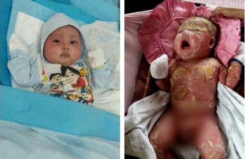 ALHAMDULILLAH...Lihat Kondisi Muhammad Alhafiz Kini, Kulitnya Bersih, Senyumnya....