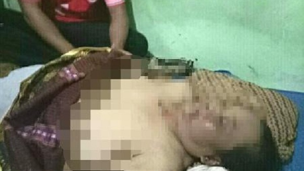 MENGENASKAN, Seorang Ibu Rumah Tangga Tewas Diinjak Gajah Liar, Tubuhnya Luka-luka dan Lebam