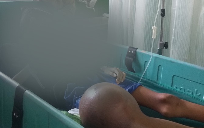 Ngeriii.. Derita Tumor, Lutut Rosita Tiap Hari Keluarkan Darah hingga Setengah Ember