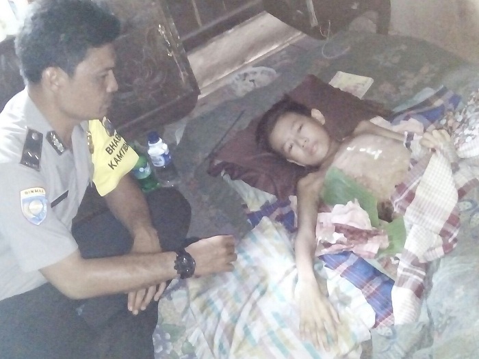 Bantu Anak Penderita Tumor, Aipda Rikson Simanungkalit Dapat Apresiasi Kapolres Inhil