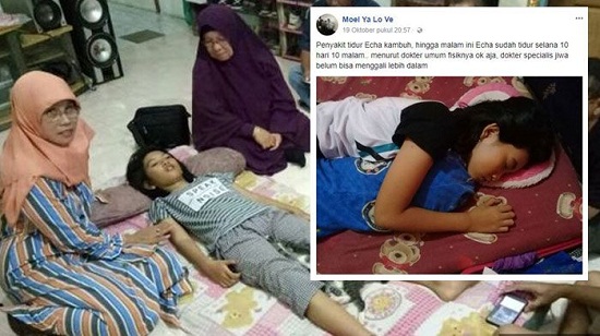 Habis Makan Nasi Goreng dan Setengah Gelas Air, Raisa 'Si Putri Tidur'  Terlelap  Sampai 14 Hari