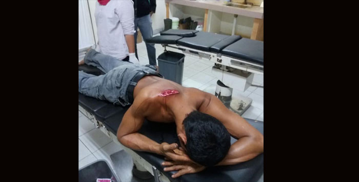DORRR... Pencuri Ternak di Kuansing Tembak Warga Kopah Pakai 'Gobok', Ini Foto Korban