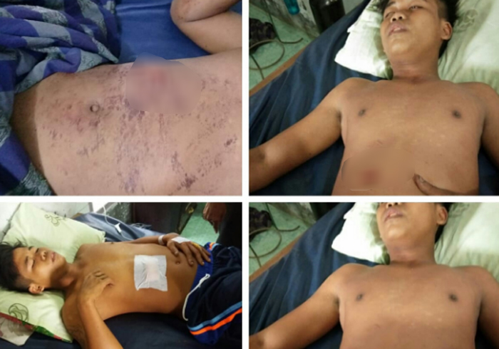 Sadis! Gara-gara Nasehati Preman Mabuk, Bejo Tewas Ditikam Pakai Pisau