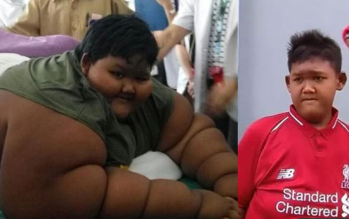 KEREN... Dari 192 Kg, Berat Badan Arya  Permana Tinggal 90 Kg, Ini Penampilannya Sekarang
