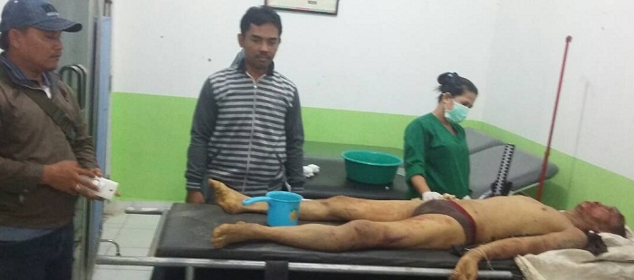 Ya Tuhannn... Malaikat Mati Setelah Dihajar Massa karena Mencuri