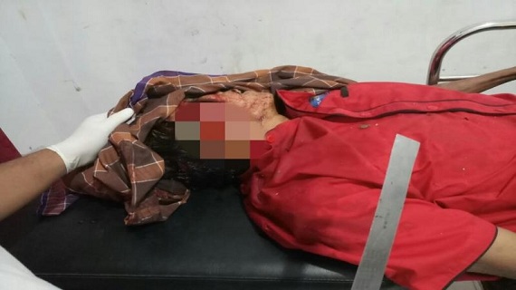 Aktivis LSM Bersimbah Darah di Rumahnya, Diduga Karena Sendok Motif Wayang...