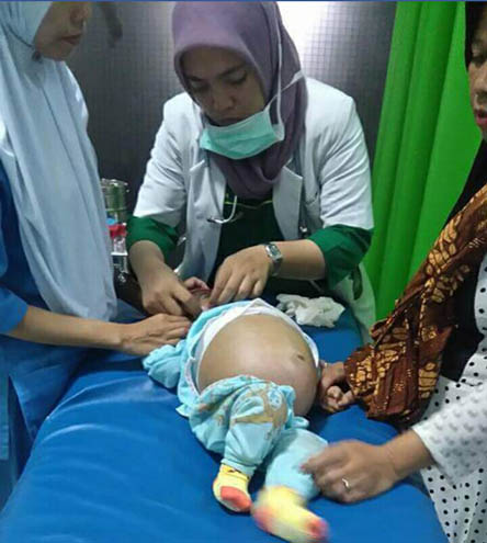INNALILLAHI...Bayi Pasien Atresia Bilier Asal Inhil Meninggal Dunia di Jakarta