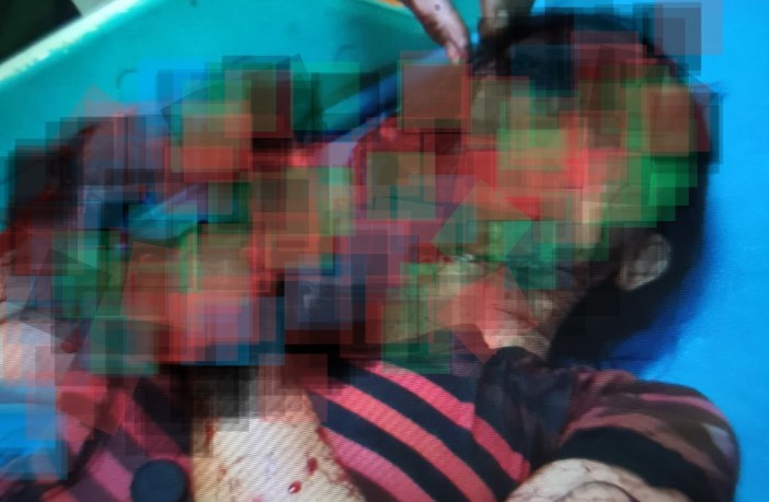 Misterius! Keluarga Perawat Dibacok dengan Sadis, Tak Ada Barang Hilang, Polisi Kerahkan Anjing Pelacak