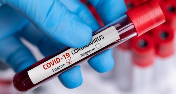 Masih Rekor, Hari Ini Kasus Positif Covid-19 Bertambah 1.111 Orang