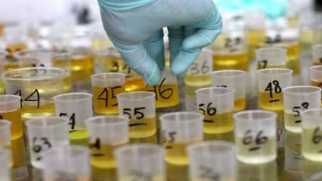 Gawat, Hasil Test Urine 3 SLTA Saja, Ratusan Pelajar Kuansing Terindikasi Menggunakan Narkoba