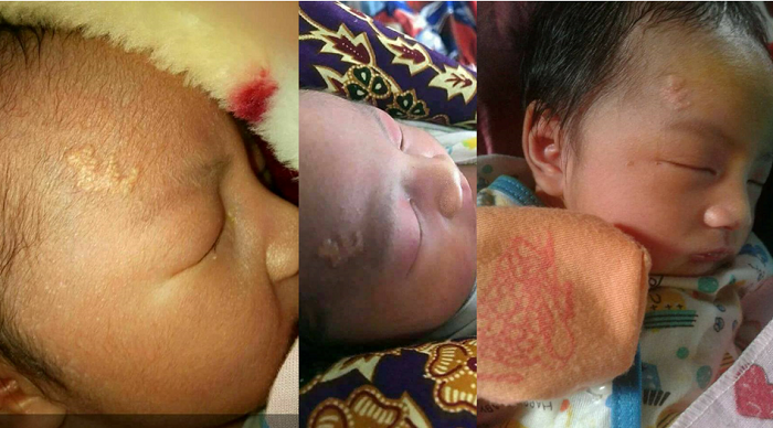ALLAHUAKBAR...Bayi ini Punya Tanda Lahir Berupa Lafal 'Allah' di Dahi, Ini Foto-fotonya