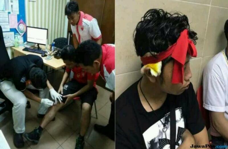 JAHAT... Timnas Kalah, Suporter Myanmar Termasuk Perempuan Malah Babak Belur Diserang Fans Malaysia, Berdarah-darah 