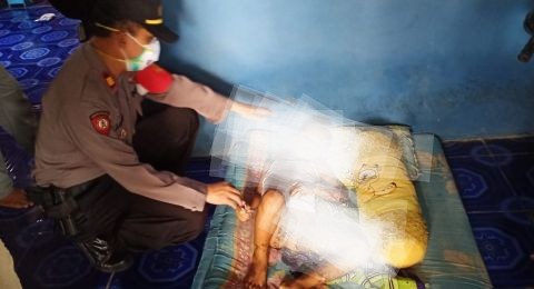 Tragis! Gegara Main Hand Sanitizer, Tubuh Bocah Ini Terbakar 