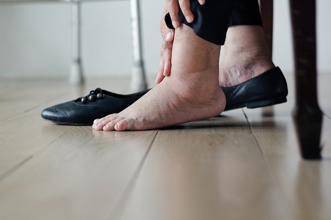 Mata Kaki Bengkak, Ini Penyebab hingga Pencegahannya