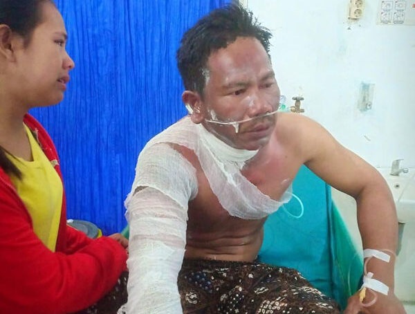 Oh Tuhan, Ribut-ribut Soal Utang Piutang, Adik Tega Bakar Abang Kandung