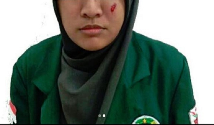 Mahasiswi Cantik Ini Jadi Korban, Forum Perempuan BEM Seluruh Indonesia Kutuk Keras Premanisme