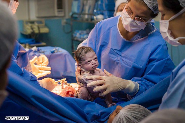 Bukannya Nangis atau Tertawa, Bayi Ini Malah Cemberut saat Baru Dilahirkan, Ini Fotonya