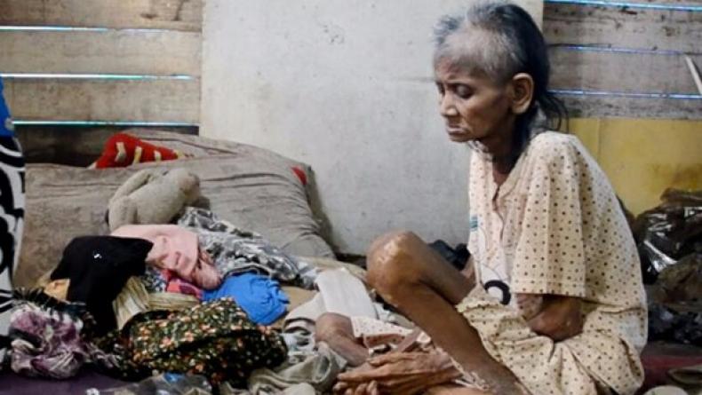 YA TUHANNN... Nenek Niarti Mengaku Bertahan Hidup Hanya dengan Air Rebusan Batu