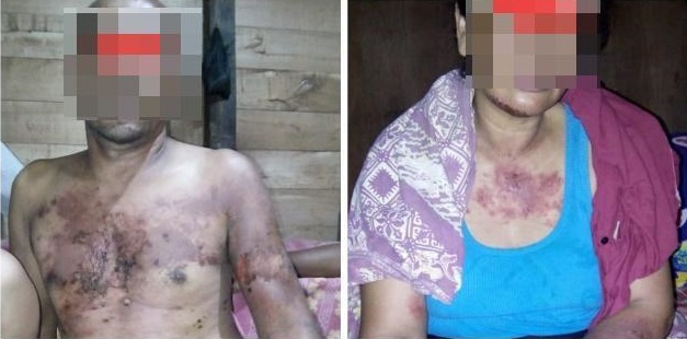 Muatan Pompong TKI Ilegal yang Tenggelam di Rupat Hanya 18 Orang, 3 Masih Hilang