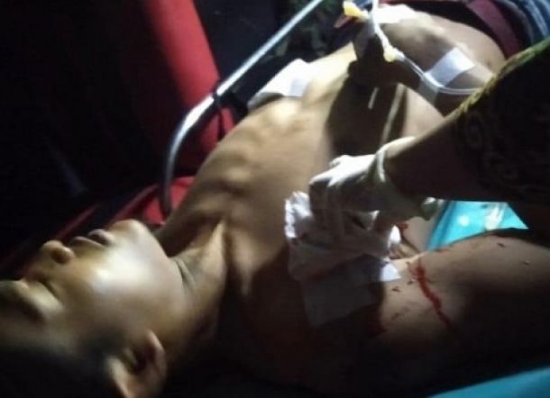Niat Baik Datang untuk Berdamai, Pemuda Malang Ini Justru Disambut dengan Tikaman Badik