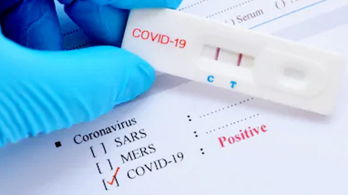 Bantah Klaim Hadi Pranoto, Kemenkes: Obat Covid-19 Belum Ditemukan di Dunia