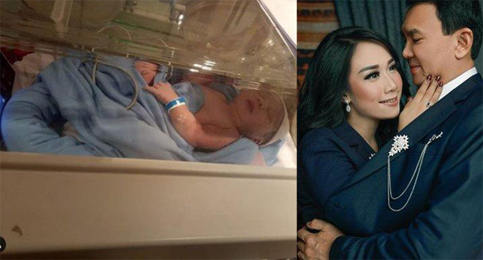 Selamat! Puput Nastiti Lahirkan Anak Ahok, Diberi Nama Yosafat Abimanyu Purnama