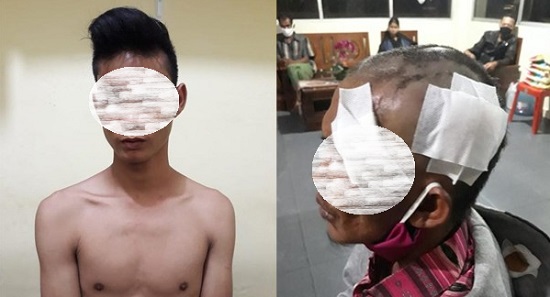 Disuruh Bangun, Pemuda Sri Meranti Hantam Kepala Ayahnya Pakai Botol, Lalu Dihajar Pakai Broti Hingga Tersungkur