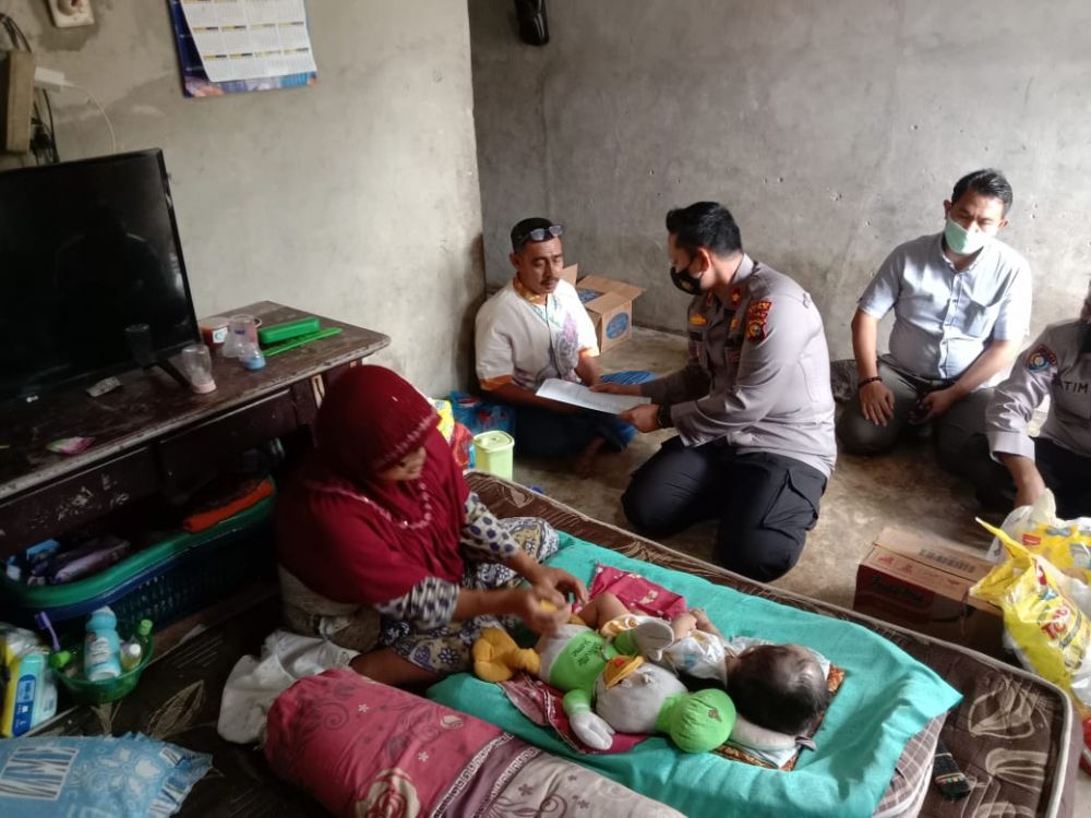 Wujud Empati dan Peduli Terhadap Sesama, Polsek Tualang Bantu Anak Penderita Hidrosefalus