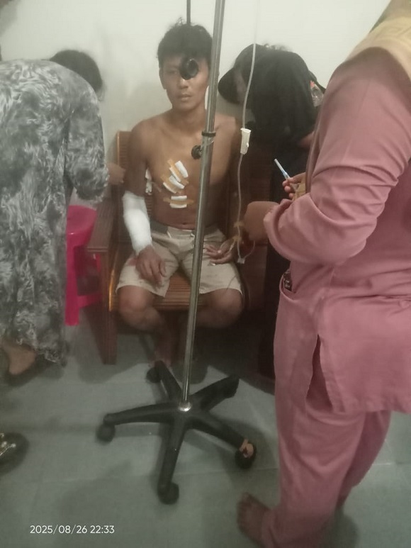 Korban Terkaman Buaya, Haris Mengalami Luka Dibagian Tangan Dan Dada Kanan, Kapolres Himbau warga agar Waspada di Aliran Sungai Teso