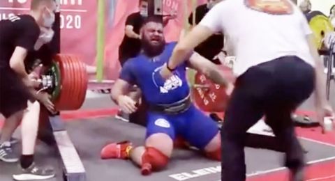 Mengerikan! Tak Kuat Angkat Beban 408 Kg, Lutut Pria Ini Langsung Patah