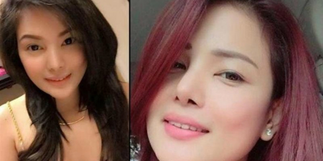Ingin Operasi Payudara dan Pantat, Pengusaha Cantik Ini Tewas Mengenaskan