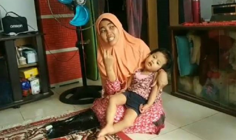 Aneh! Balita Cantik Ini Tak Bisa Bergerak Bahkan Tertawa, Dokter Bilang Idap Penyakit Langka