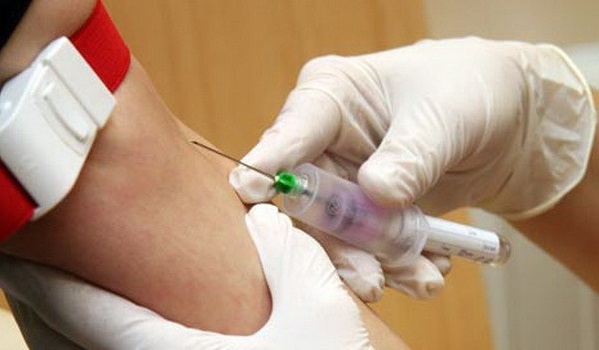 DICARI, 24 Orang untuk Disuntik Virus Corona, Dibayar Rp63 Juta, Ada Yang Mau?