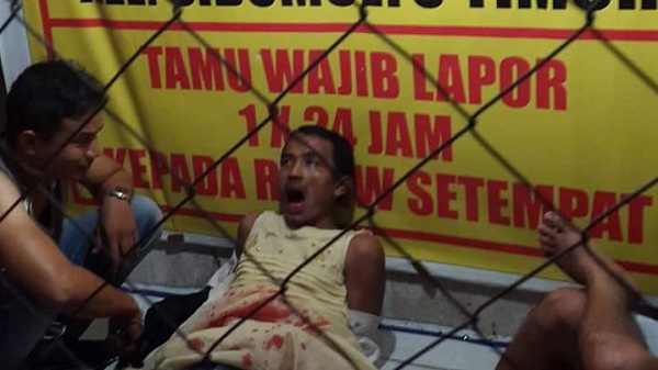 Ditangkap Karena Diduga Maling Motor, Pria Ini Teriak-teriak Seperti orang Gila...