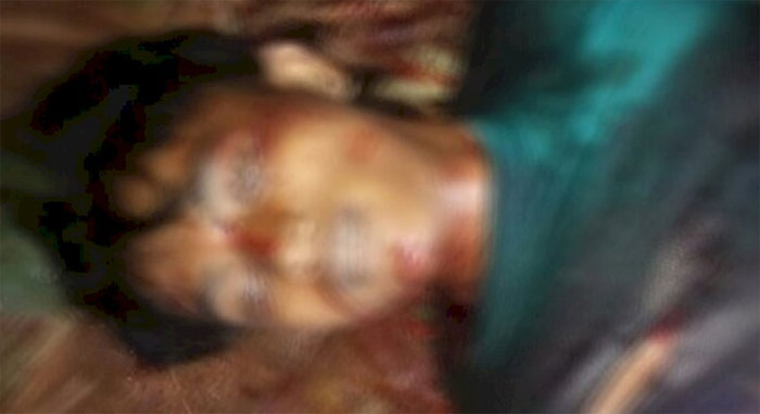 Nekat Selingkuhi Ibu Pelaku, Remaja Tewas Dicelurit di Leher, Lengan, Perut dan Pantat