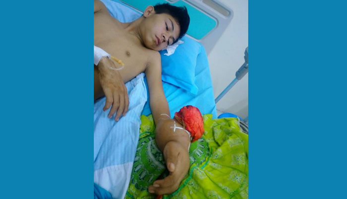 MOHON BANTUAN...Remaja di Menaming-Rohul Ini Derita Kanker, Kini Dirawat di RSUD Arifin Achmad