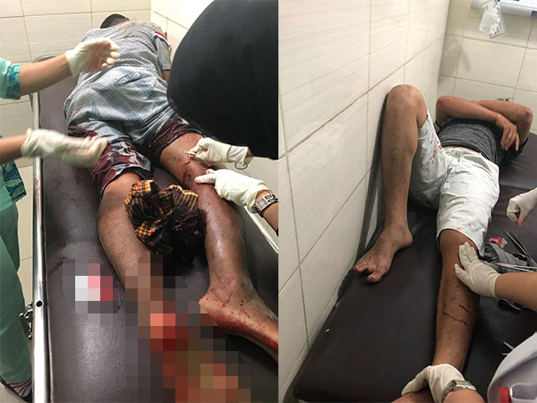 DOR DOR DOR... Bawa 15 Kg Sabu, Oknum Polisi Temannya Ditembak, Untung Tak Mati