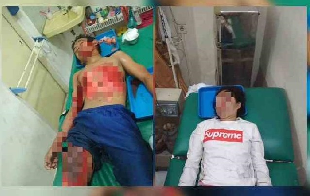 Terseret 60 Meter di Kolong Pikap di Pasar Rakyat Rengat, Riska Tewas, Agung Luka Parah