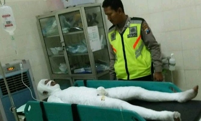 NGERI... Pria Ini Terbakar saat Isi Pertalite di Jeriken, Lihat Fotonya 